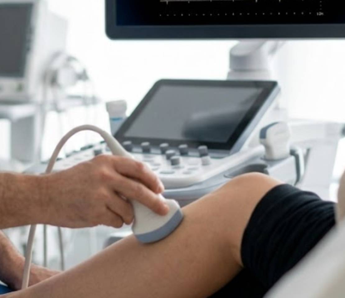 Doppler vascular: você sabe quando precisa fazer esse exame? 